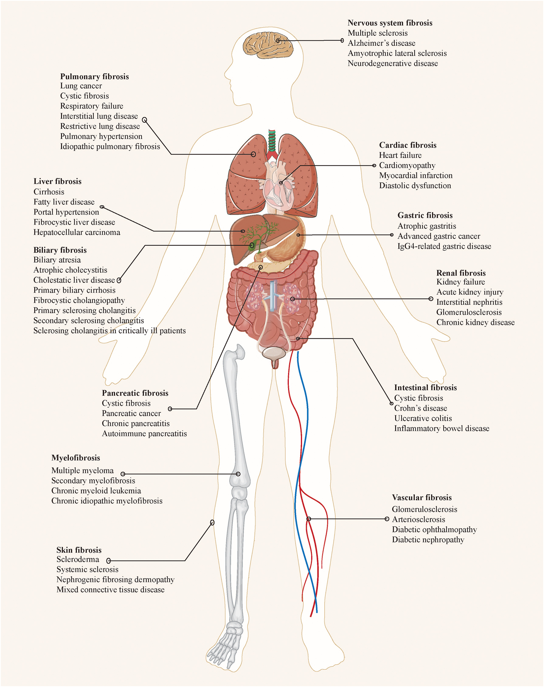 Figure 1: 
Common organ fibrosis and related diseases.