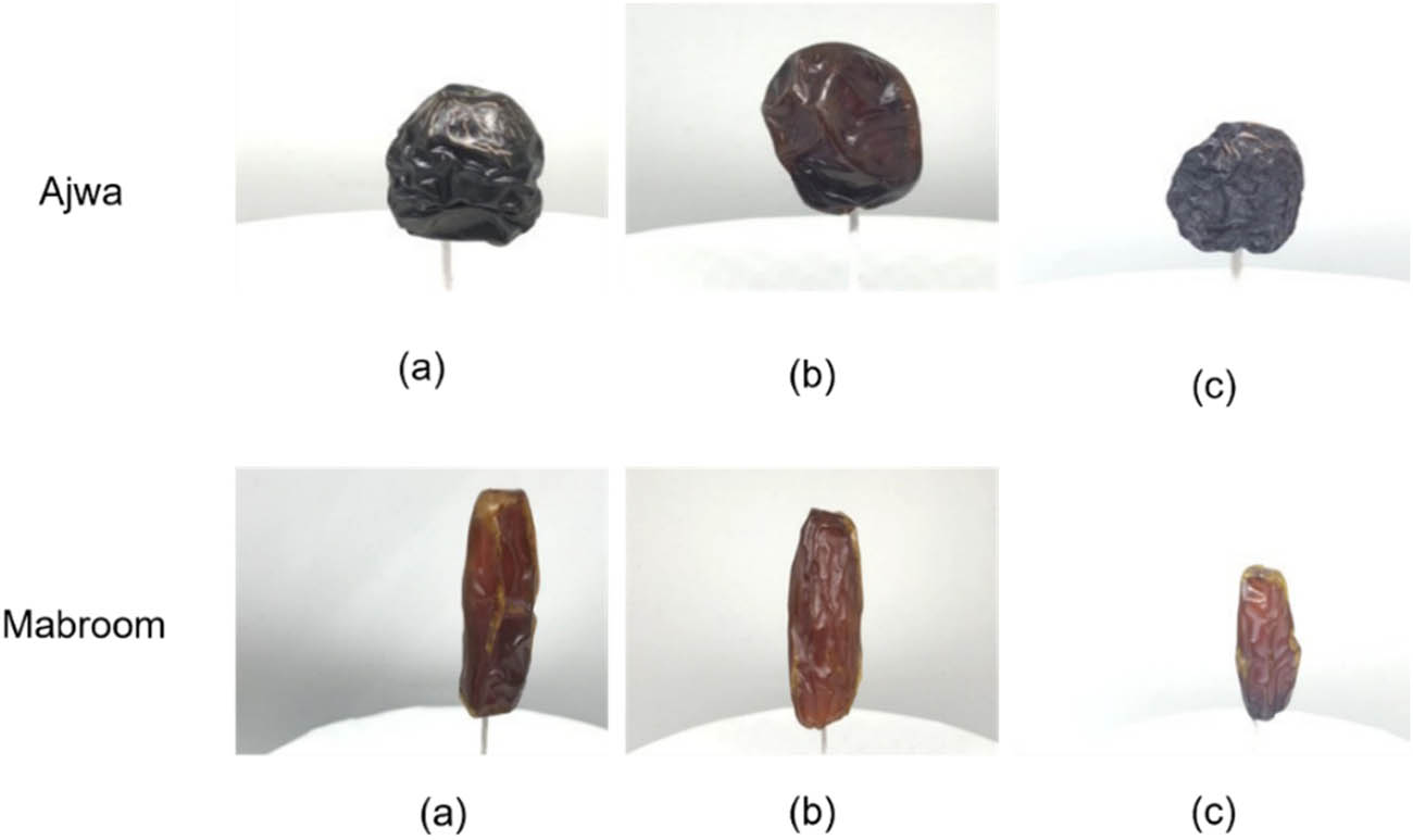 Figure 3
Sample images from the TU-DG Dataset: (a) Grade 1, (b) Grade 2, and (c) Grade 3.